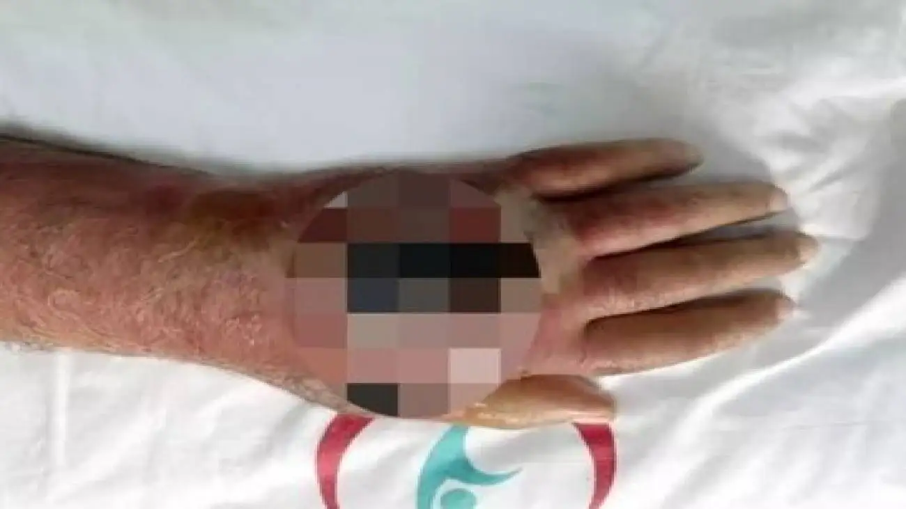 مغازه دار استانبولی، قربانی دندان های سارق حرفه ای شد -  عکس