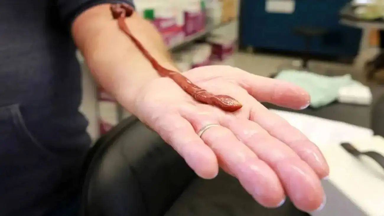 سن یک کرم آزمایشگاهی همه را غافلگیر کرد