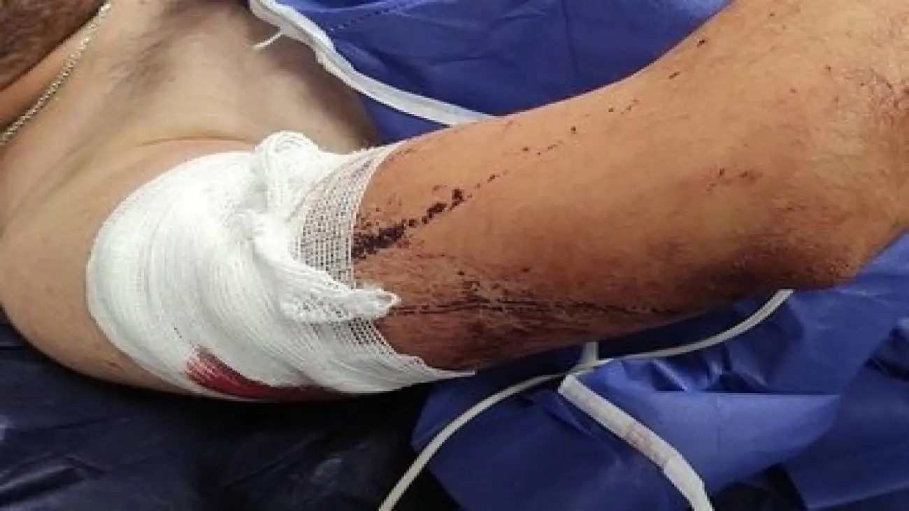 باز هم زورگیری از یک دانشجو -  این بار گرگان