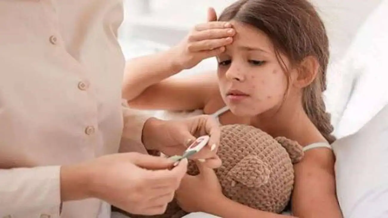 آبله مرغان برای چه کسانی خطرناک است؟
