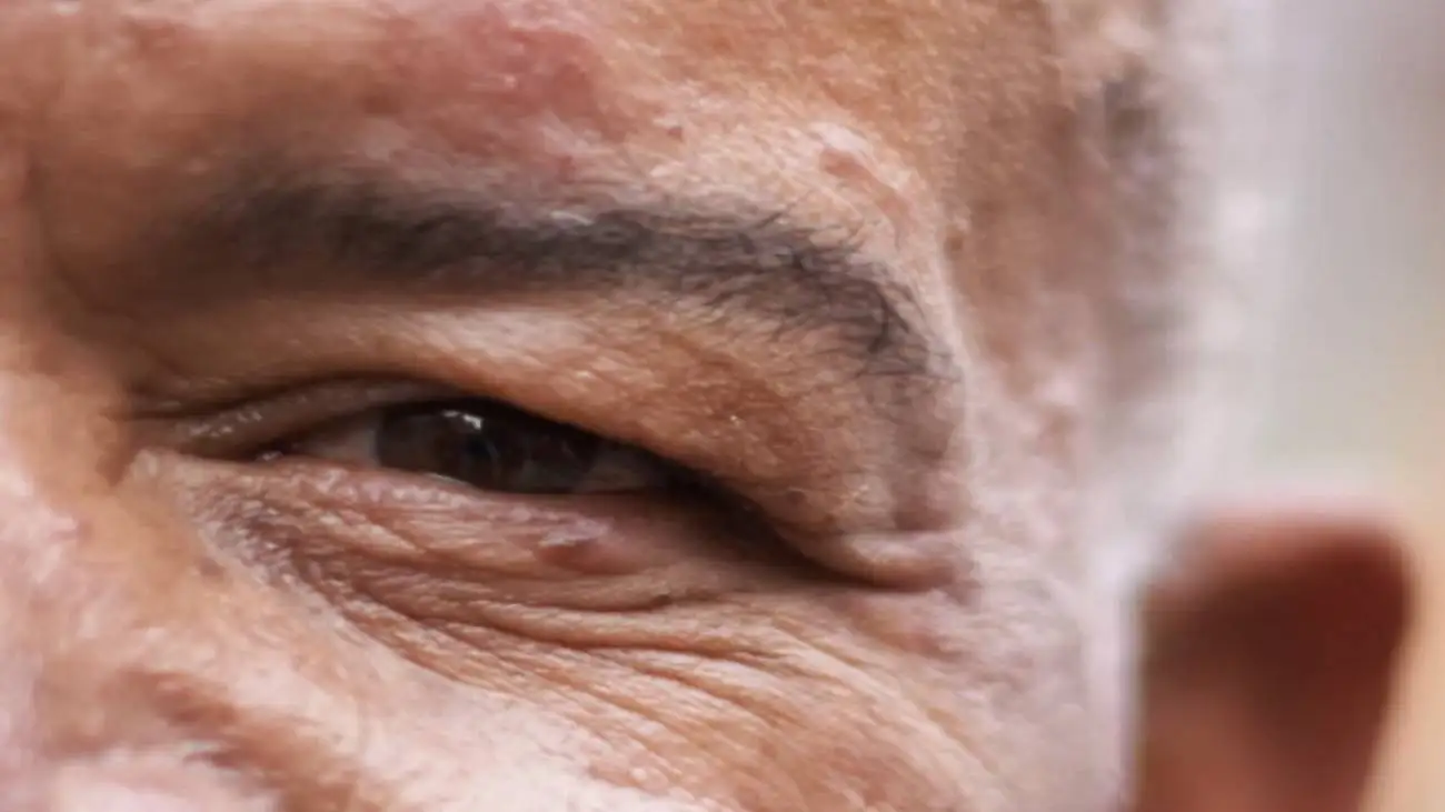 befast؛ این علائم را برای سکته مغزی به خاطر بسپارید