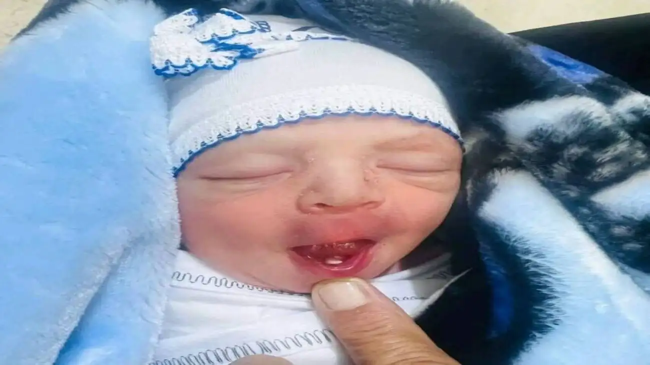 نوزاد عراقی با دندان به دنیا آمد؛ ببینید + عکس