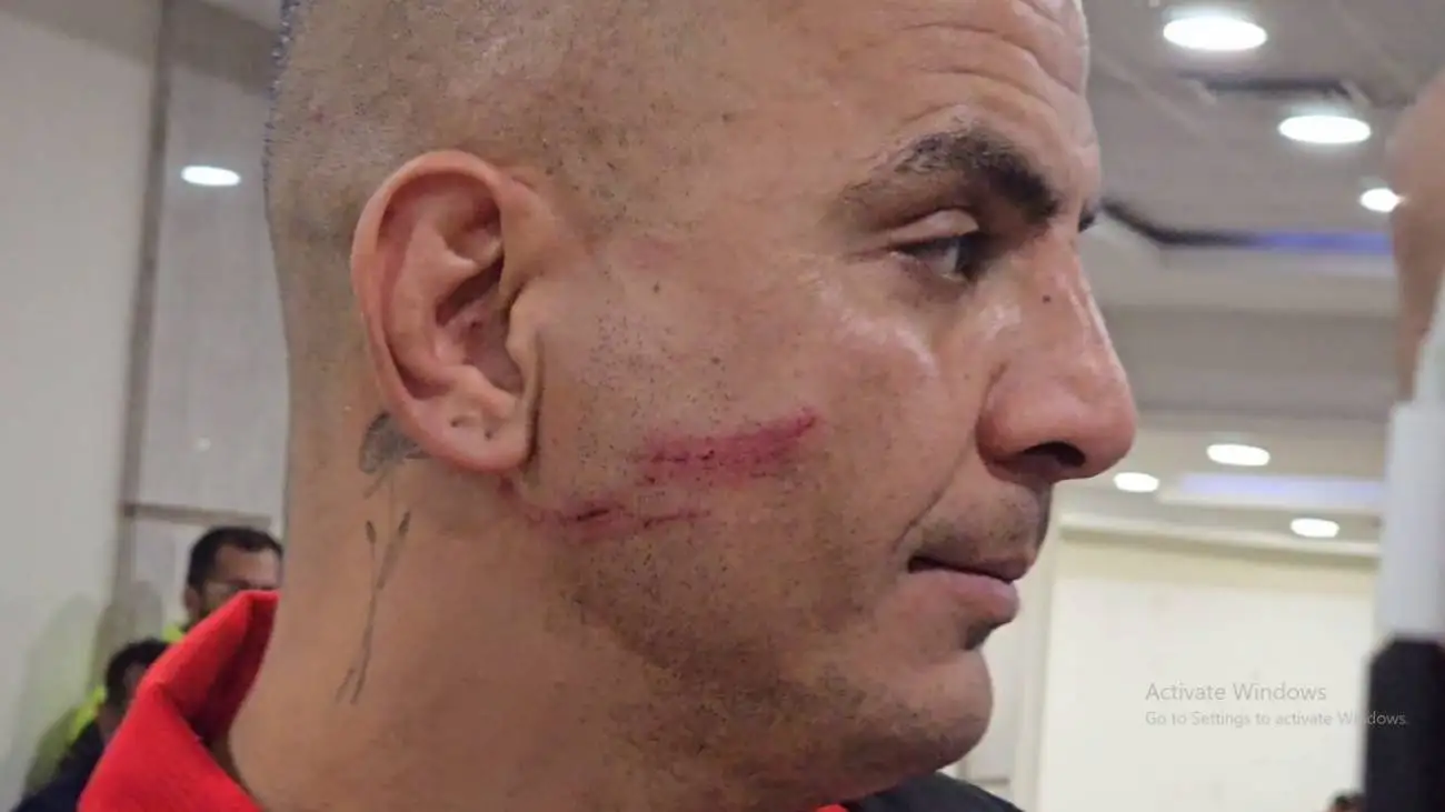 ویدیو  -  برخورد شدید حامد لک با بازیکن ذوب آهن؛ شبیه اسکار فیس شدم!