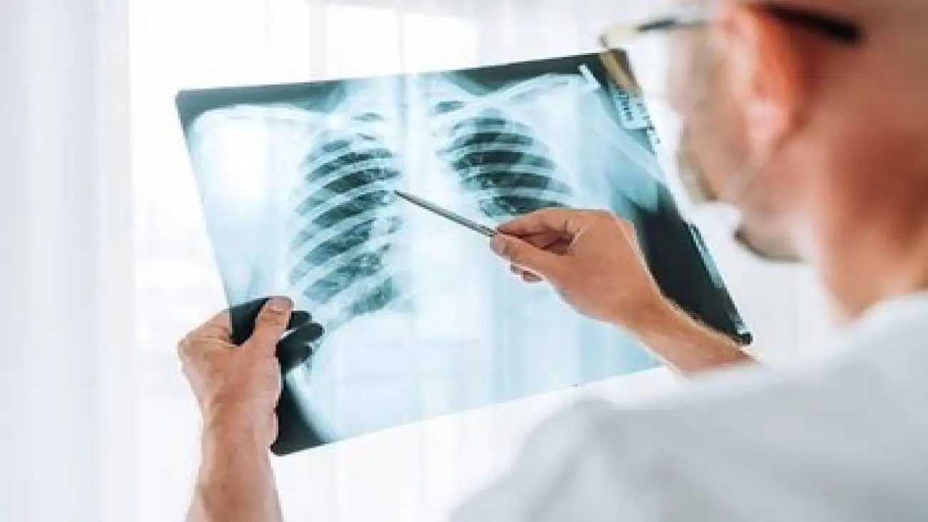 چرا آنفلوآنزا گاهی کشنده می شود؟