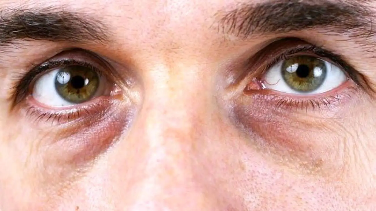 چطور با افزایش سن، بینایی سالم تر و شفاف تری داشته باشیم؟