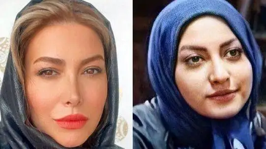 ویدیو -  فریبا نادری، پریسیمای سریال (ستایش): زندگی من به قبل و بعد از عمل بینی تقسیم میشه -  بینی من هم عقابی بود هم کوفته !