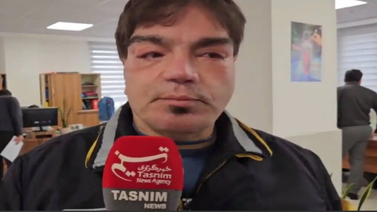 نخستین تصویر از مردی که عمل بلفارو کرده بود + ویدئو  -  بی خیال عربلو نمی شوم  -  9 بار به اتاق بیهوشی رفتم