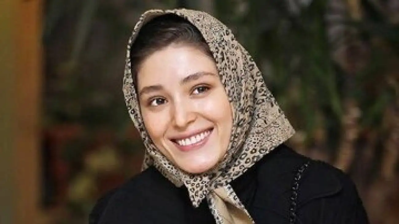 تصویر  -  صورت کبود فرشته حسینی با چشم خون ریزی کرده!
