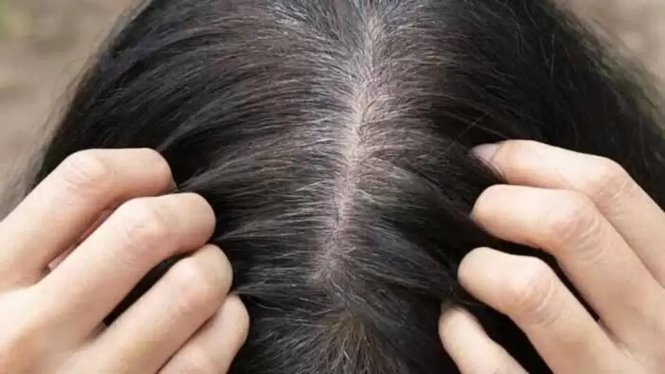 آیا موهای سفید دوباره سیاه می شوند؟