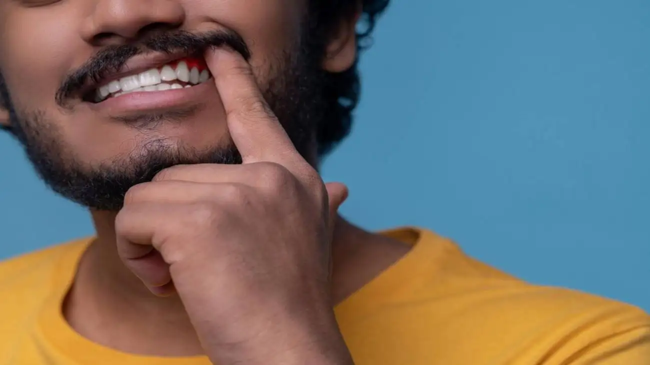 7 روش خانگی برای پاک کردن لکه های قهوه ای روی دندان  -  چگونه دندان هایمان را مثل برف سفید کنیم ؟