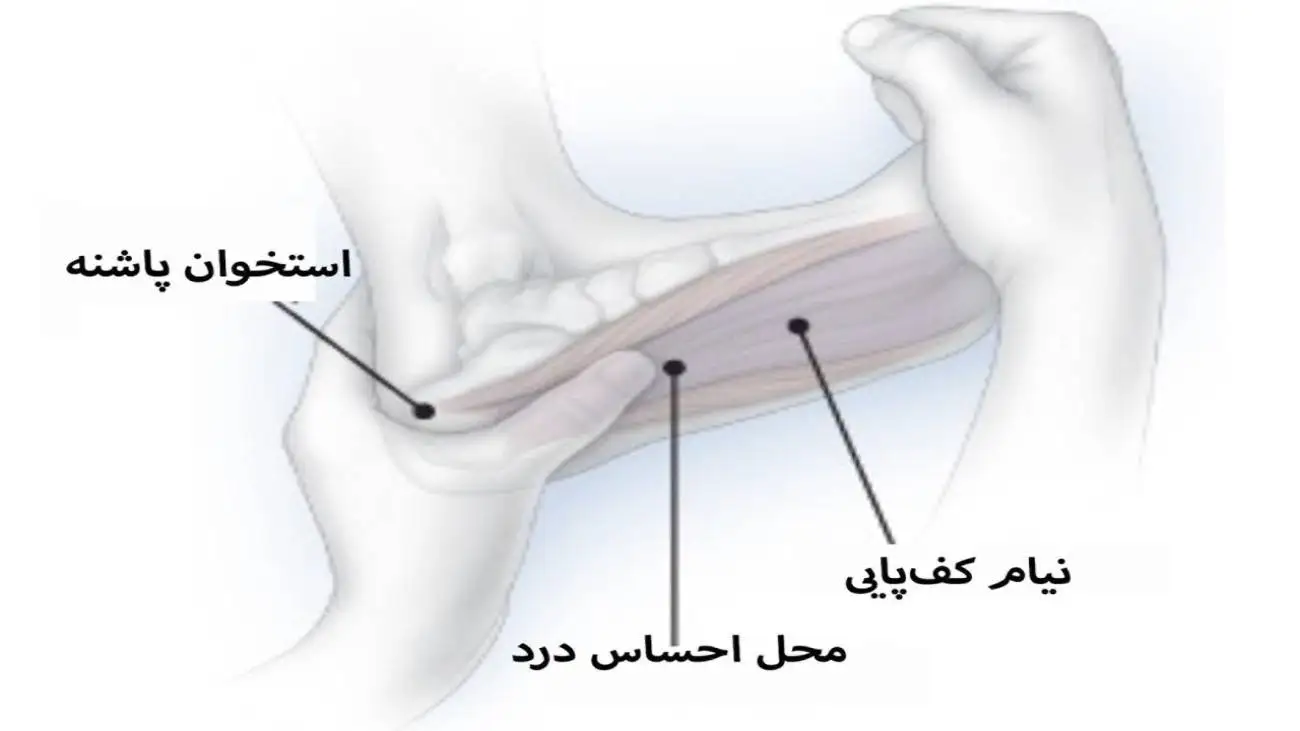 درمان های خانگی برای درد پاشنه پا