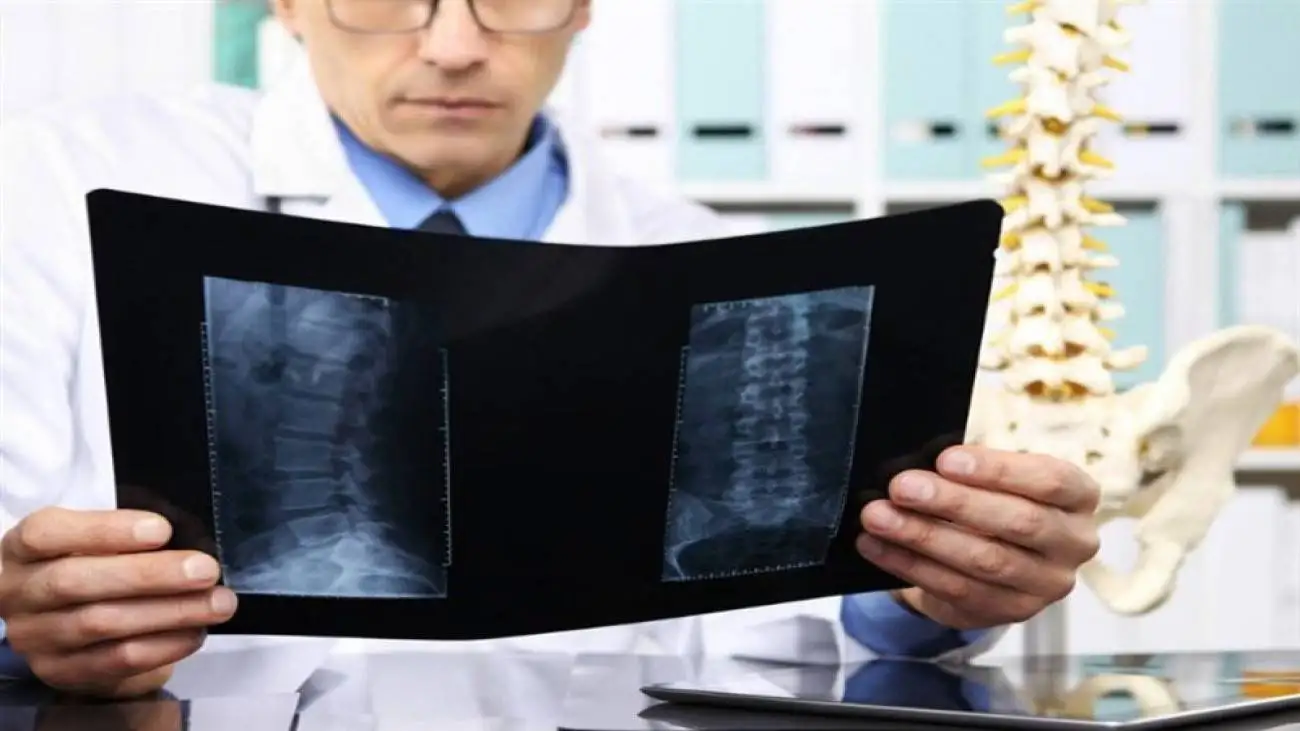 5 روش عالی برای داشتن استخوان های محکم و سالم