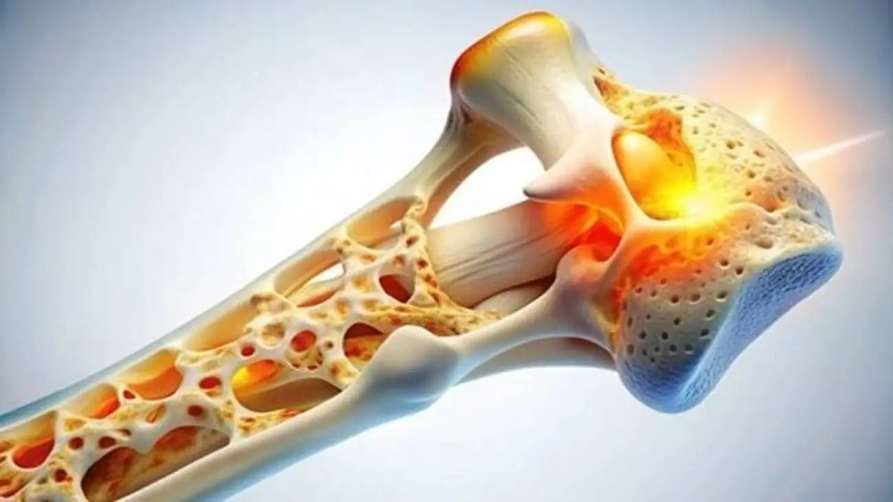 کدام خوراکی ها برای سلامت استخوان ها خطرناکند؟