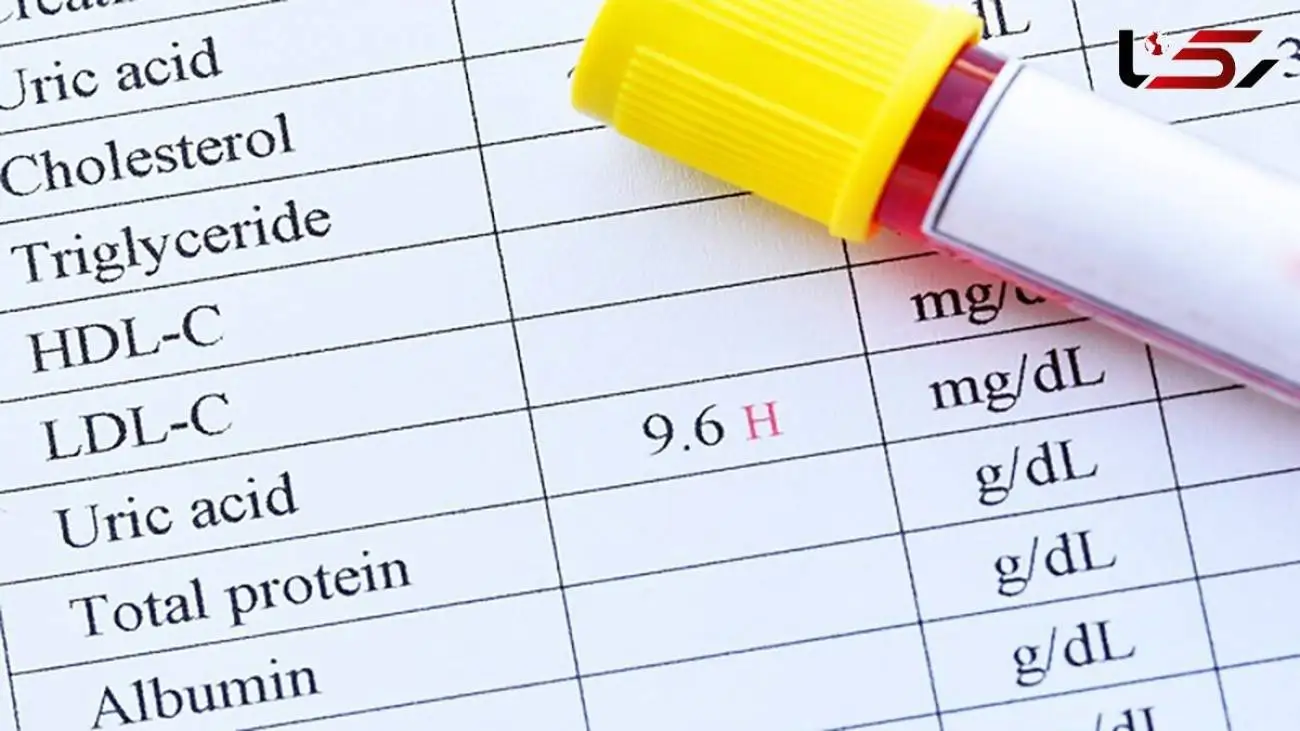 معرفی بهترین خوراکی ها برای کاهش اوره و غذاهایی که باید از آنها پرهیز کرد