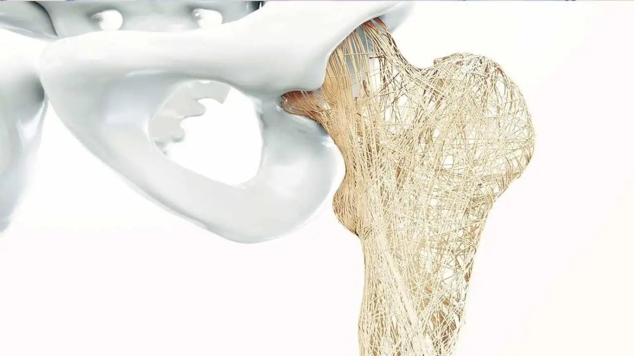 هشدار به زنان ؛ بیماری خاموشی که بی صدا استخوان ها را می شکند!