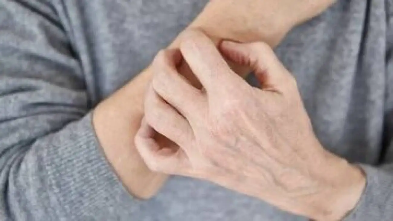 این نشانه ها یعنی بیماری پوستی