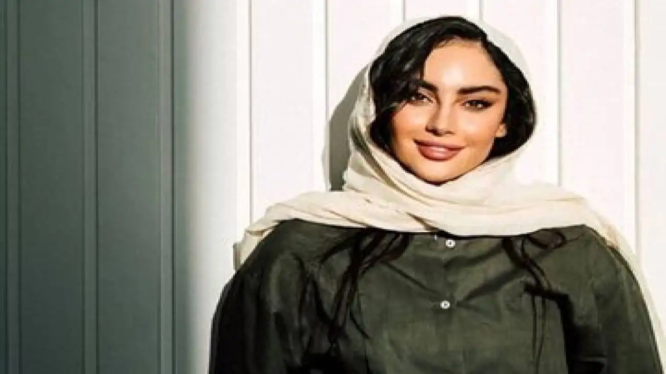 تصویر  -  تغییر چهره دوباره ترلان پروانه؛ این بازیگر زن چه کرده است؟