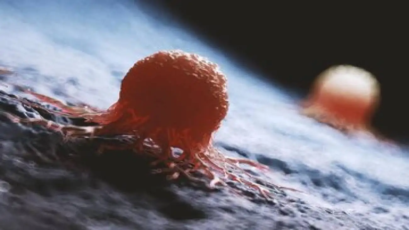 غذاهایی که خطر ابتلا به سرطان را افزایش می دهند