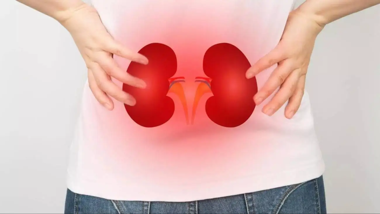 فعالیت در این ساعت خطر سنگ کلیه را افزایش می دهد