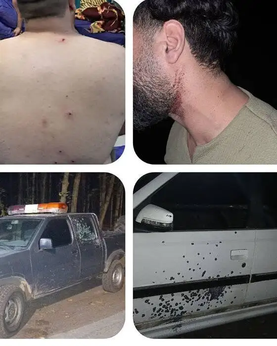 زخمی شدن فرمانده یگان و 2 مامور منابع طبیعی در تیراندازی قاچاقچیان + ویدئوی حمله و تصاویر زخمی ها