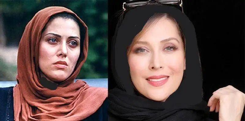 رونمایی از تصاویر قبل عمل زیبایی بازیگران زن ایرانی - از شیلا خداداد تا نیوشا ضیغمی+عکس