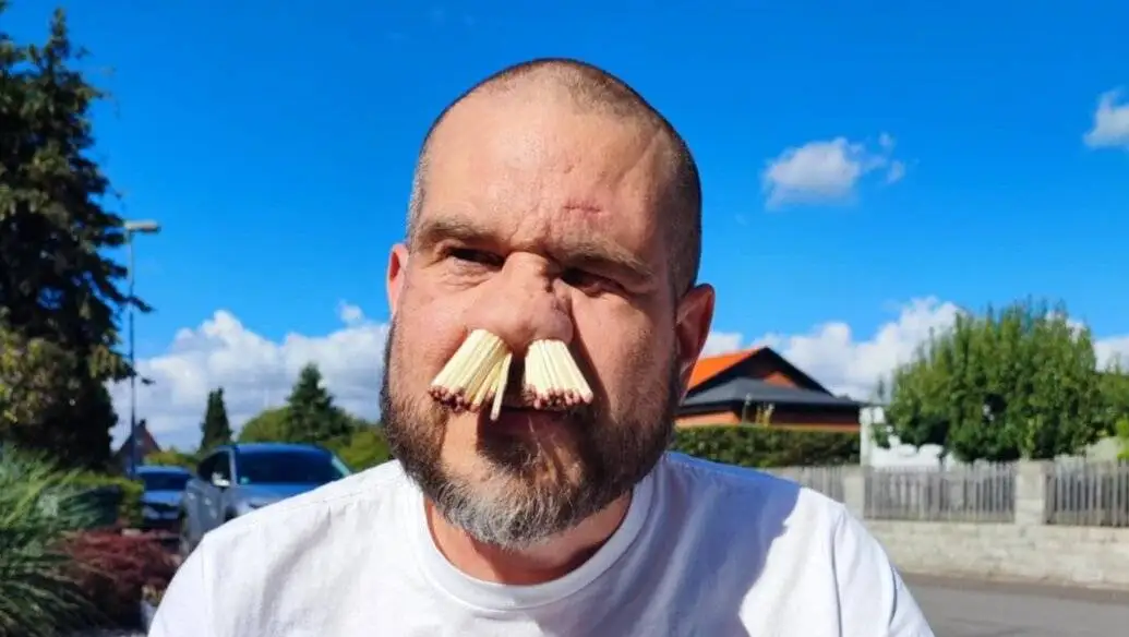 جالب ترین رکوردهای گینس 2025؛ از نگه داشتن چوب کبریت در میانی تا خوک اسکیت باز