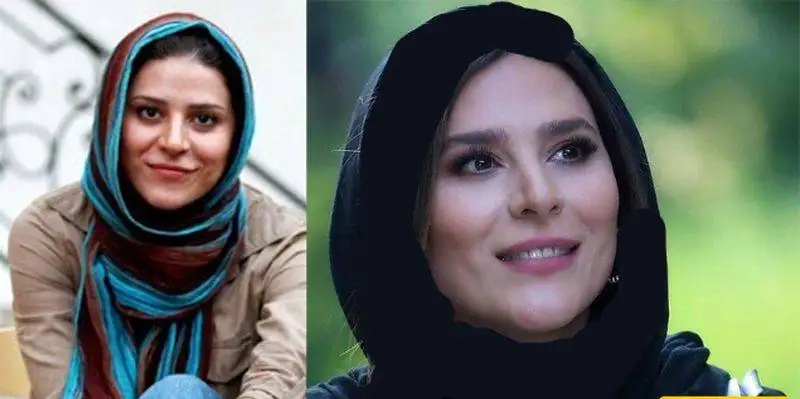 رونمایی از تصاویر قبل عمل زیبایی بازیگران زن ایرانی - از شیلا خداداد تا نیوشا ضیغمی+عکس