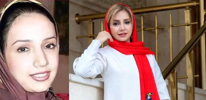 رونمایی از تصاویر قبل عمل زیبایی بازیگران زن ایرانی - از شیلا خداداد تا نیوشا ضیغمی+عکس