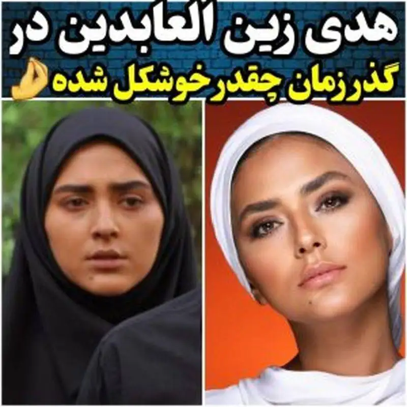 تغییرات جذاب هدی زین العابدین از سریال سقوط یک فرشته تا به الان! - چی بود و چی شد!