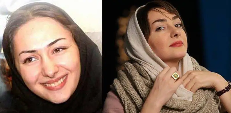 رونمایی از تصاویر قبل عمل زیبایی بازیگران زن ایرانی - از شیلا خداداد تا نیوشا ضیغمی+عکس