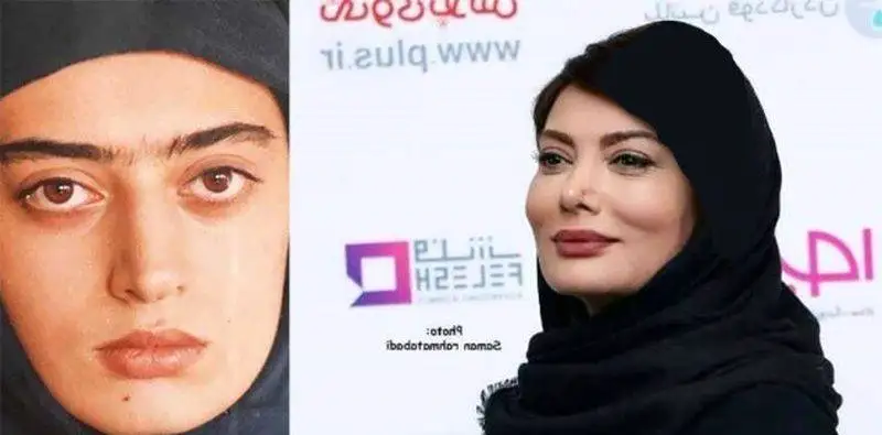رونمایی از تصاویر قبل عمل زیبایی بازیگران زن ایرانی - از شیلا خداداد تا نیوشا ضیغمی+عکس