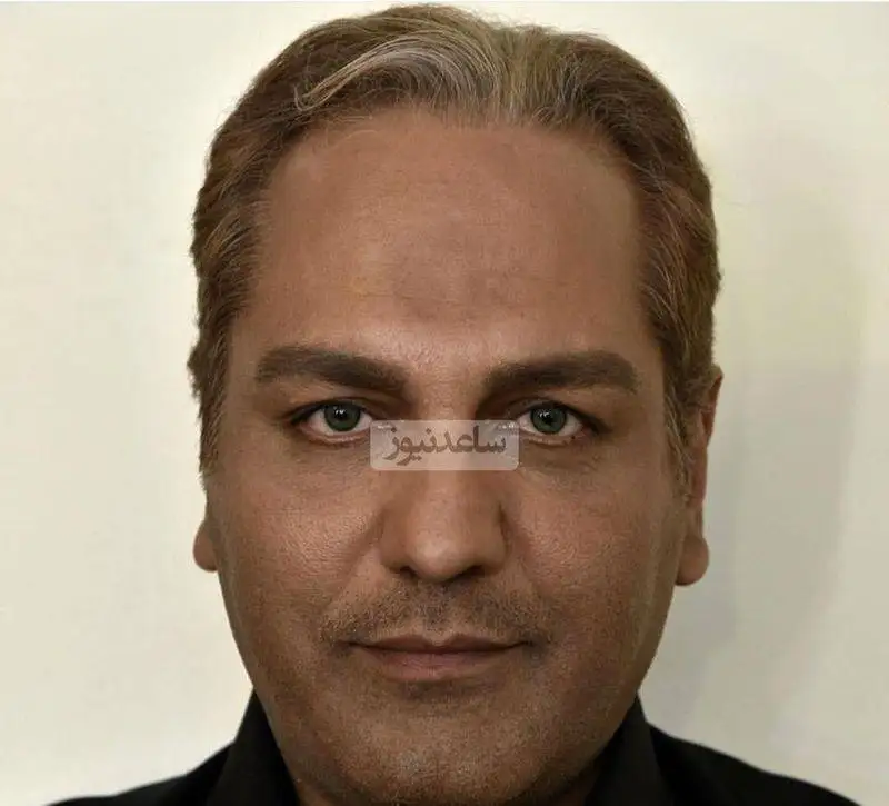 عکس - تغییر چهره ناگوار مهران مدیری - آقای بازیگر قابل شناسایی نیست !