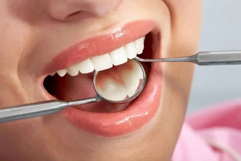 7 روش خانگی برای پاک کردن لکه های قهوه ای روی دندان - چگونه دندان هایمان را مثل برف سفید کنیم ؟