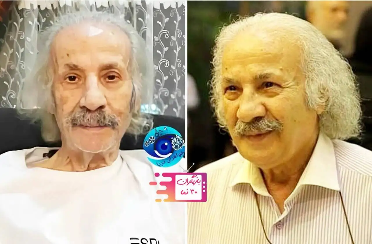 چهره غم انگیز بازیگر شب های برره بعد از بیماری!