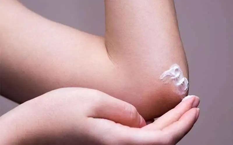 بهترین روش های خانگی برای رفع تیرگی زانو و آرنج