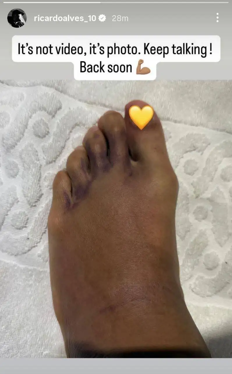 تصویری جالب از پای مصدوم بازیکن سپاهان