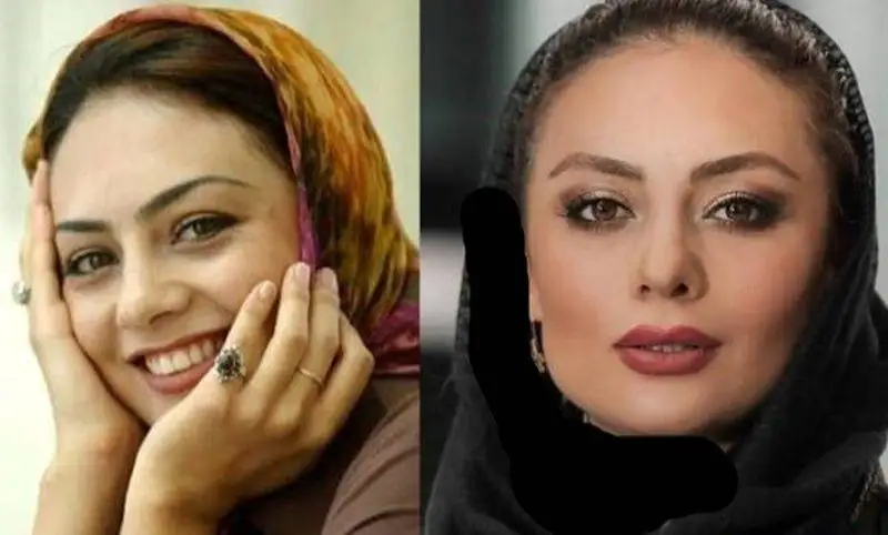 رونمایی از تصاویر قبل عمل زیبایی بازیگران زن ایرانی - از شیلا خداداد تا نیوشا ضیغمی+عکس