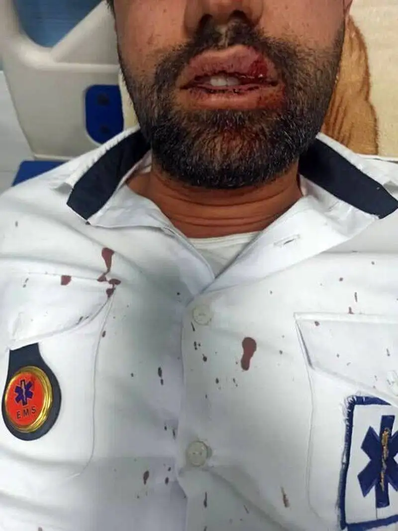 تکنسین اورژانس چهارمحال و بختیاری قربانی خشونت + جزئیات