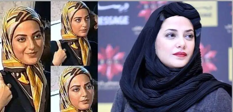 رونمایی از تصاویر قبل عمل زیبایی بازیگران زن ایرانی - از شیلا خداداد تا نیوشا ضیغمی+عکس