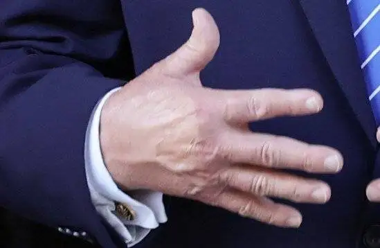 دست ترامپ را این بار رنگ کردند! + تصاویر