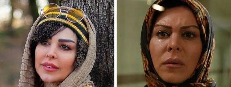 رونمایی از تصاویر قبل عمل زیبایی بازیگران زن ایرانی - از شیلا خداداد تا نیوشا ضیغمی+عکس
