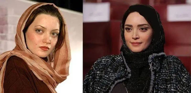 رونمایی از تصاویر قبل عمل زیبایی بازیگران زن ایرانی - از شیلا خداداد تا نیوشا ضیغمی+عکس