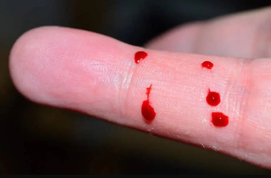 نوجوانی که با خونش را خورد و مسموم شد