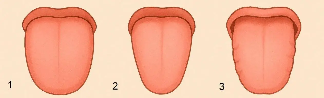 تشخیص انواع بیماری ها با بررسی زبان - رد دندان روی زبان نشانه چیست؟