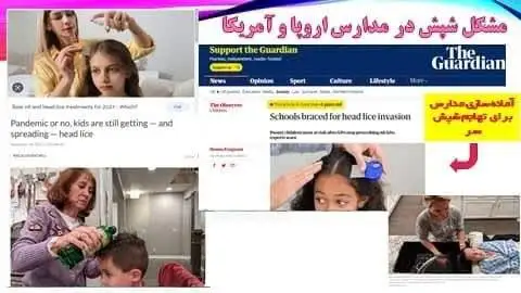 واقعیت شوکه کننده ؛ در آکسفورد شپش عادی است! - خیلی کار خوبی کردم برگشتم ایران