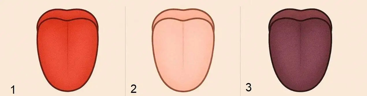 تشخیص انواع بیماری ها با بررسی زبان - رد دندان روی زبان نشانه چیست؟