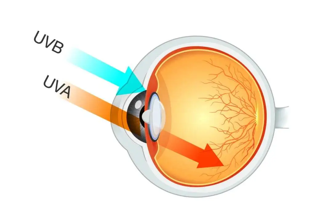اشعه ماورا بنفش باعث چه بیماری هایی می شود ؟ + راه حل های محافظتی در مقابل اشعه uv