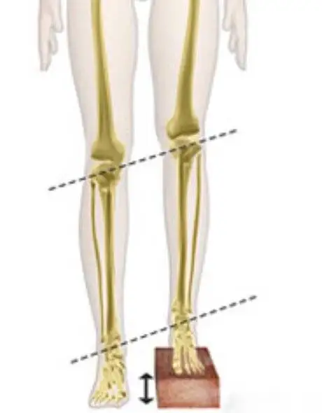 جراحی جالب برای یافتن همسر