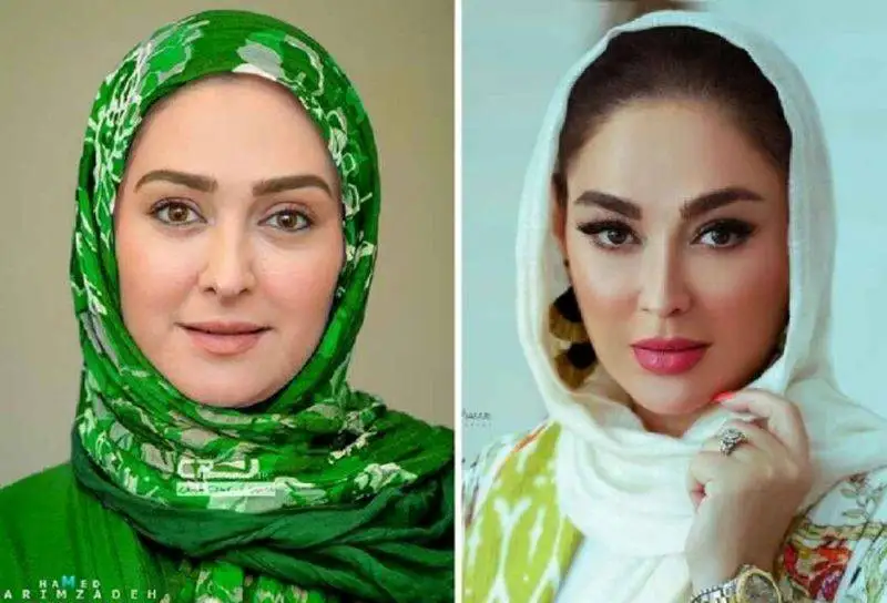 رونمایی از تصاویر قبل عمل زیبایی بازیگران زن ایرانی - از شیلا خداداد تا نیوشا ضیغمی+عکس