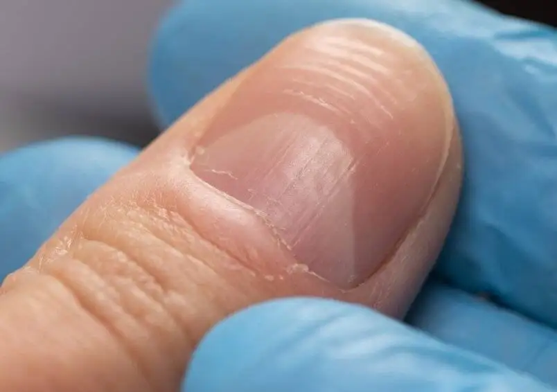 اسراری که هلال ماه ناخن برملا می کند